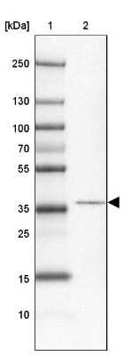 Western Blot: CCDC113 Antibody [NBP2-14443]