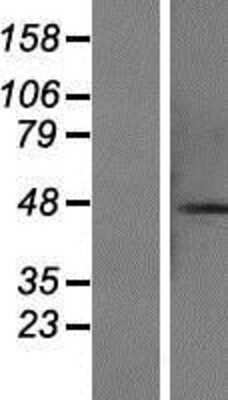 Western Blot: CCDC113 Overexpression Lysate [NBP2-07375]