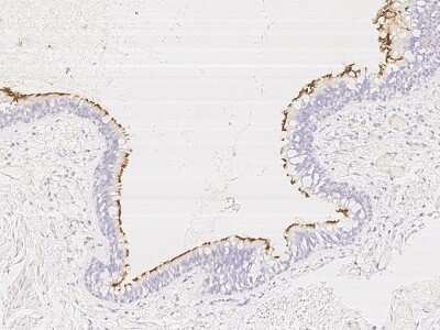 Immunohistochemistry: CCDC114 Antibody [NBP3-06293]