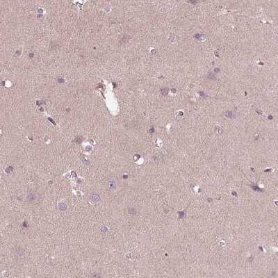 Immunohistochemistry-Paraffin: CCDC114 Antibody [NBP1-93863]