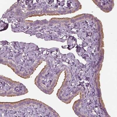 Immunohistochemistry-Paraffin: CCDC114 Antibody [NBP1-93863]