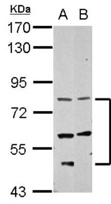 Western Blot: CCDC114 Antibody [NBP2-15740]