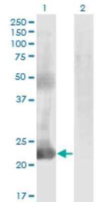 Western Blot: CCDC115 Antibody (4E9) [H00084317-M05]