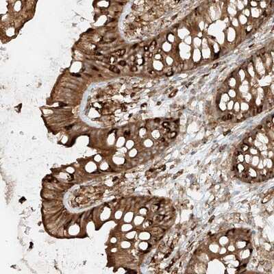 Immunohistochemistry-Paraffin: CCDC115 Antibody [NBP1-86568]