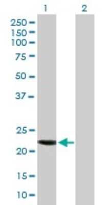 Western Blot: CCDC115 Antibody [H00084317-B01P]