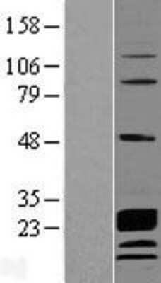 Western Blot: CCDC115 Overexpression Lysate [NBL1-08769]