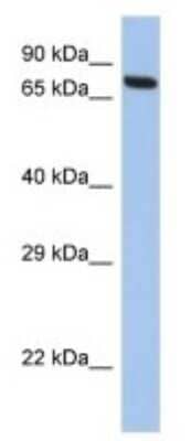 Western Blot: CCDC116 Antibody [NBP3-10623]