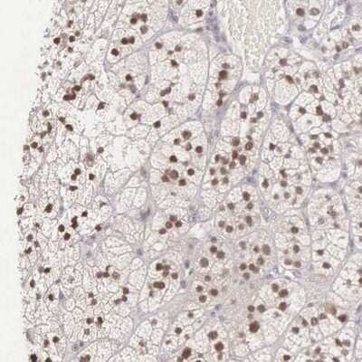 Immunohistochemistry-Paraffin: CCDC117 Antibody [NBP1-81977]