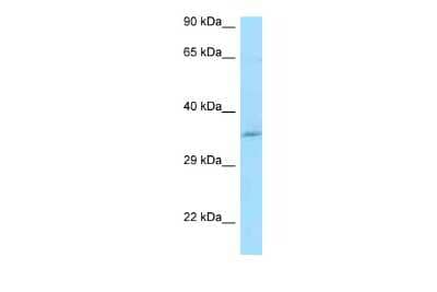 Western Blot: CCDC117 Antibody [NBP2-84597]