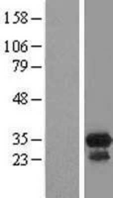 Western Blot: CCDC117 Overexpression Lysate [NBL1-08770]