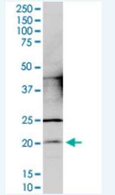 Western Blot: CCDC12 Antibody (7B1) [H00151903-M05-100ug]