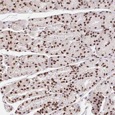 Immunohistochemistry: CCDC12 Antibody [NBP2-30374]