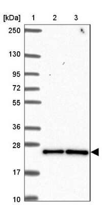 Western Blot: CCDC12 Antibody [NBP2-30374]