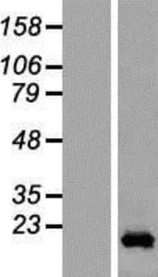 Western Blot: CCDC12 Overexpression Lysate [NBL1-08771]