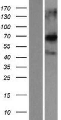 Western Blot: CCDC120 Overexpression Lysate [NBP2-05872]