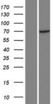 Western Blot: CCDC120 Overexpression Lysate [NBP2-10155]