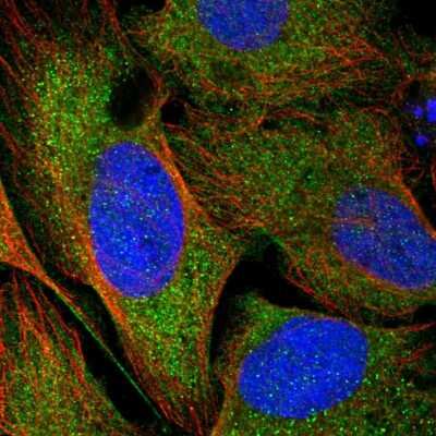 Immunocytochemistry/ Immunofluorescence: CCDC121 Antibody [NBP2-14744]