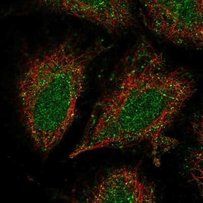 Immunocytochemistry/ Immunofluorescence: CCDC122 Antibody [NBP2-54949]