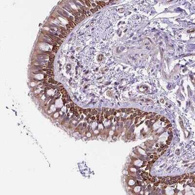 Immunohistochemistry: CCDC122 Antibody [NBP2-49335]