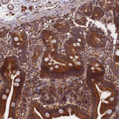 Immunohistochemistry-Paraffin: CCDC124 Antibody [NBP2-48746]