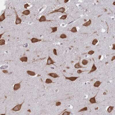 Immunohistochemistry-Paraffin: CCDC124 Antibody [NBP2-48858]