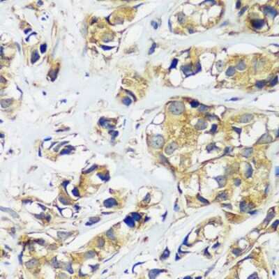 Immunohistochemistry-Paraffin: CCDC124 Antibody - Azide and BSA Free [NBP2-92737]