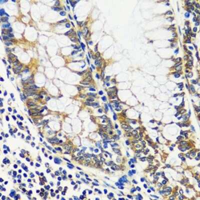 Immunohistochemistry-Paraffin: CCDC124 Antibody - Azide and BSA Free [NBP2-92737]