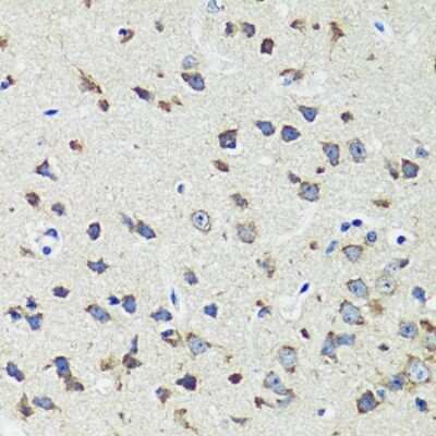 Immunohistochemistry-Paraffin: CCDC124 Antibody - Azide and BSA Free [NBP2-92737]