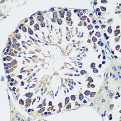 Immunohistochemistry-Paraffin: CCDC124 Antibody - Azide and BSA Free [NBP2-92737]