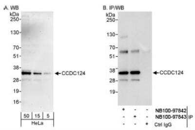 Western Blot: CCDC124 Antibody [NB100-97843]