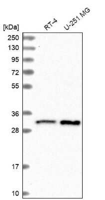 Western Blot: CCDC124 Antibody [NBP2-48746]