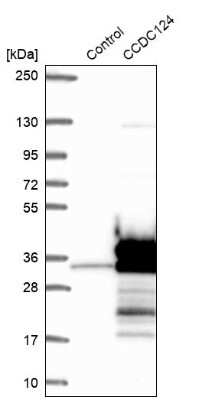 Western Blot: CCDC124 Antibody [NBP2-48746]
