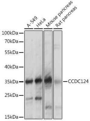 Western Blot: CCDC124 AntibodyAzide and BSA Free [NBP2-92737]