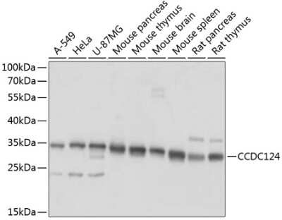 Western Blot: CCDC124 AntibodyAzide and BSA Free [NBP2-92740]