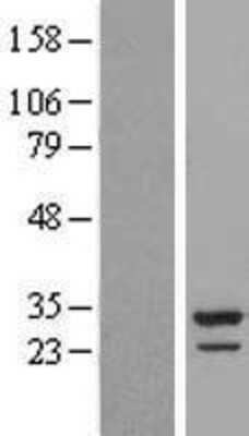 Western Blot: CCDC124 Overexpression Lysate [NBP2-09609]