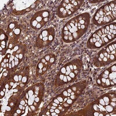 Immunohistochemistry-Paraffin: CCDC125 Antibody [NBP1-93660]