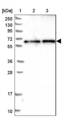 Western Blot: CCDC125 Antibody [NBP1-93660]