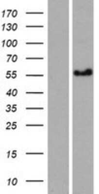 Western Blot: CCDC125 Overexpression Lysate [NBP2-04999]