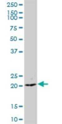 Western Blot: CCDC126 Antibody [H00090693-B01P]