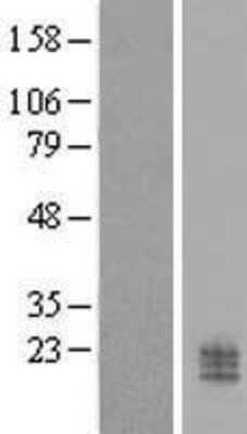 Western Blot: CCDC126 Overexpression Lysate [NBL1-08775]