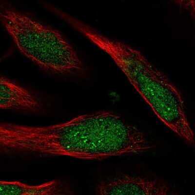 Immunocytochemistry/ Immunofluorescence: CCDC127 Antibody [NBP1-91756]