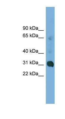 Western Blot: CCDC127 Antibody [NBP1-57061]