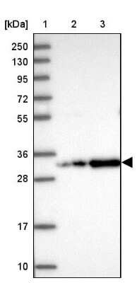 Western Blot: CCDC127 Antibody [NBP1-91756]