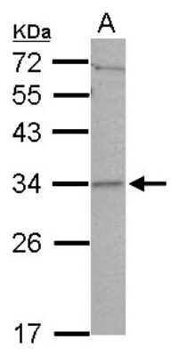 Western Blot: CCDC127 Antibody [NBP2-15741]