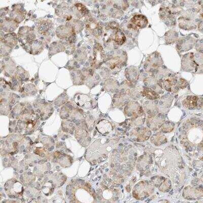 Immunohistochemistry-Paraffin: CCDC129 Antibody [NBP1-93802]