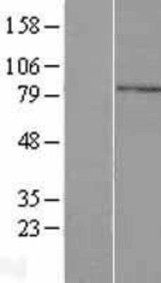 Western Blot: CCDC13 Overexpression Lysate [NBL1-08777]