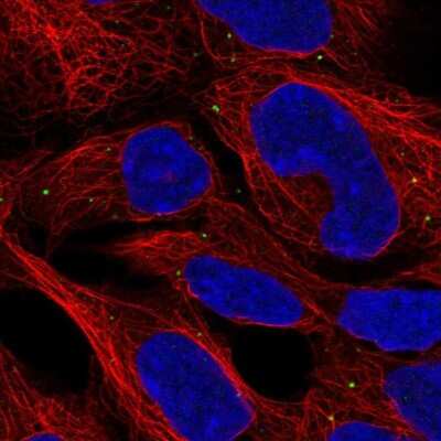 Immunocytochemistry/ Immunofluorescence: CCDC130 Antibody [NBP2-30959]