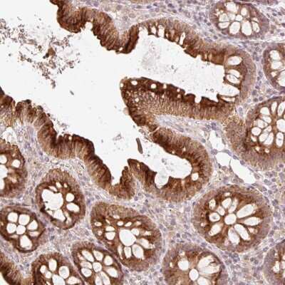 Immunohistochemistry-Paraffin: CCDC130 Antibody [NBP2-30959]