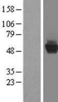 Western Blot: CCDC130 Overexpression Lysate [NBL1-08778]