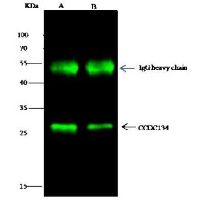 Immunoprecipitation: CCDC134 Antibody [NBP3-00083]